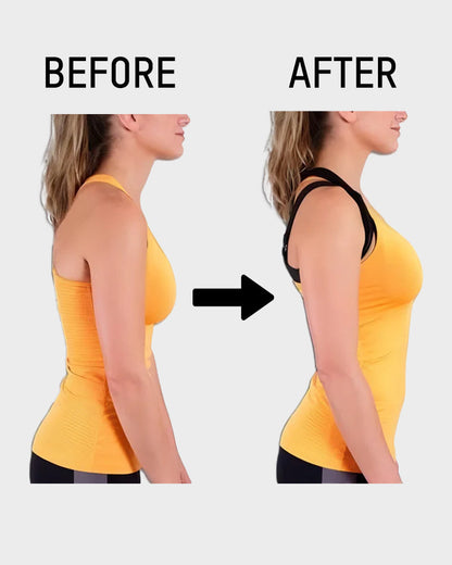 🎉LAST DAY SALE -30% OFF⚡Front Closure Cross-Back Wireless Posture Bra